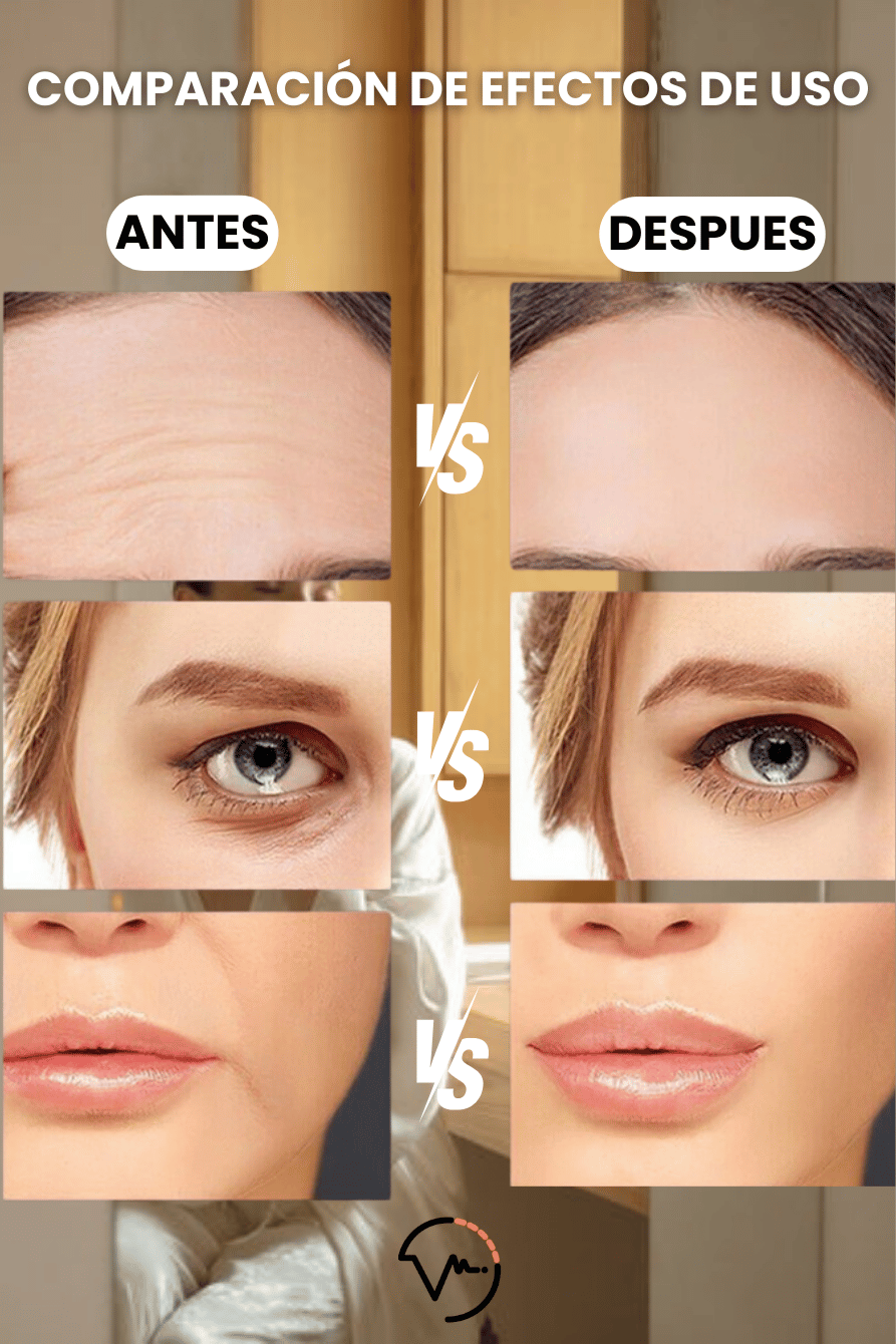 SkinPro®-Masajeador de Microcorriente