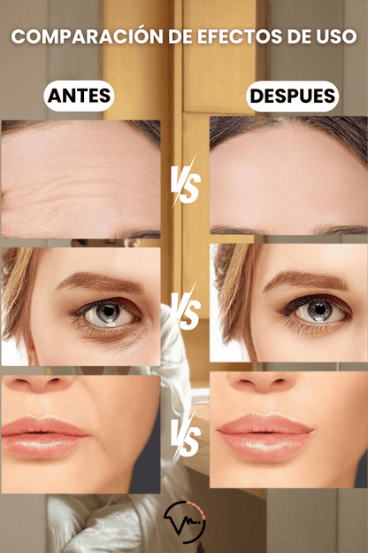 SkinPro®-Masajeador de Microcorriente